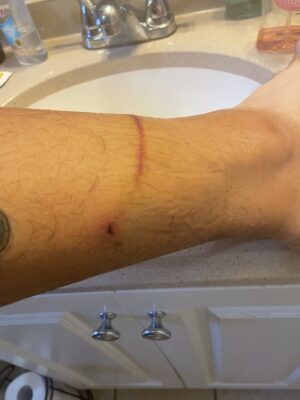 Is this cat scratch dangerous? : r/cats